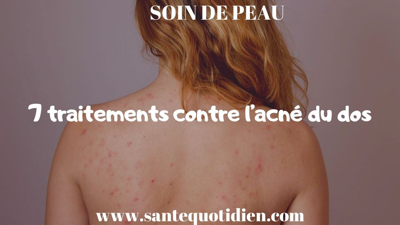 7 traitements contre l'acné du dos
