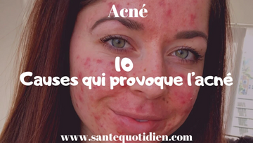 10 causes qui provoque l’acné