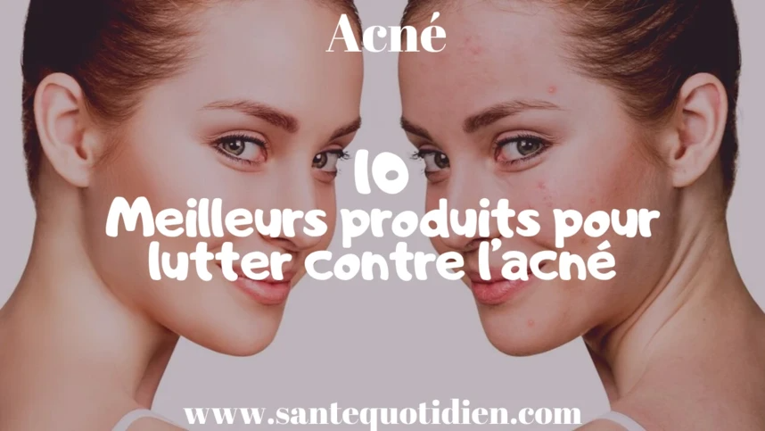 Les 10 meilleurs produits pour lutter contre l’acné
