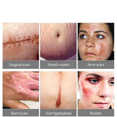 serum anti tache cicatrice