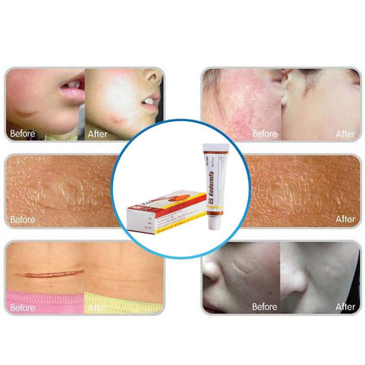 Crème cicatrisante visage - Accélérez la guérison de vos blessures cutanées