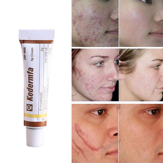 Crème cicatrisante visage - Accélérez la guérison de vos blessures cutanées